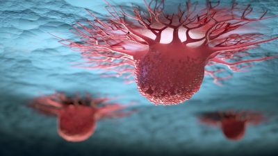 Kanseri erken aşamada tespit etmenin yolu: Sinsice ilerliyor