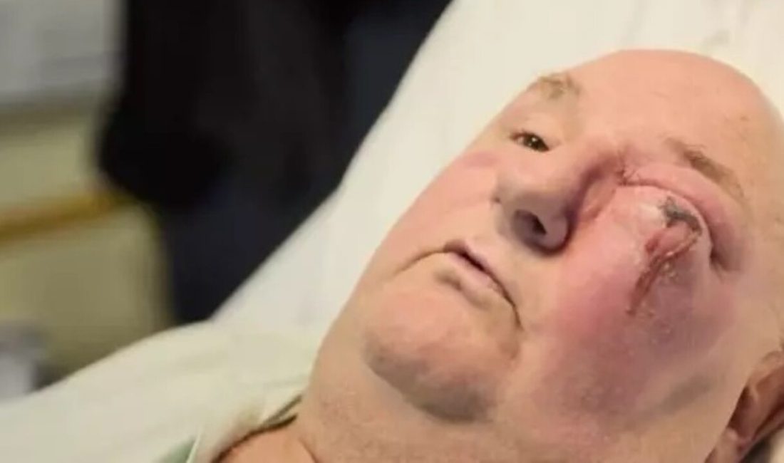 İngiltere'nin Cambridge şehrinde Terry