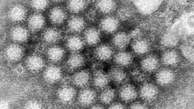 Koronavirüs’ten sonra şimdi de norovirüs başladı