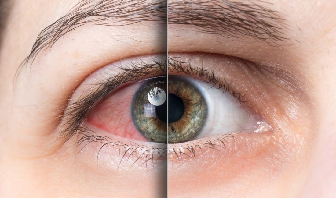 Gözünü sık ovuşturanları korkutan