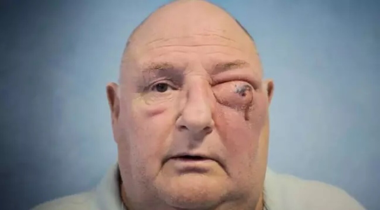 Diş ağrısıyla gitti, et yiyen hastalıkla tanıştı