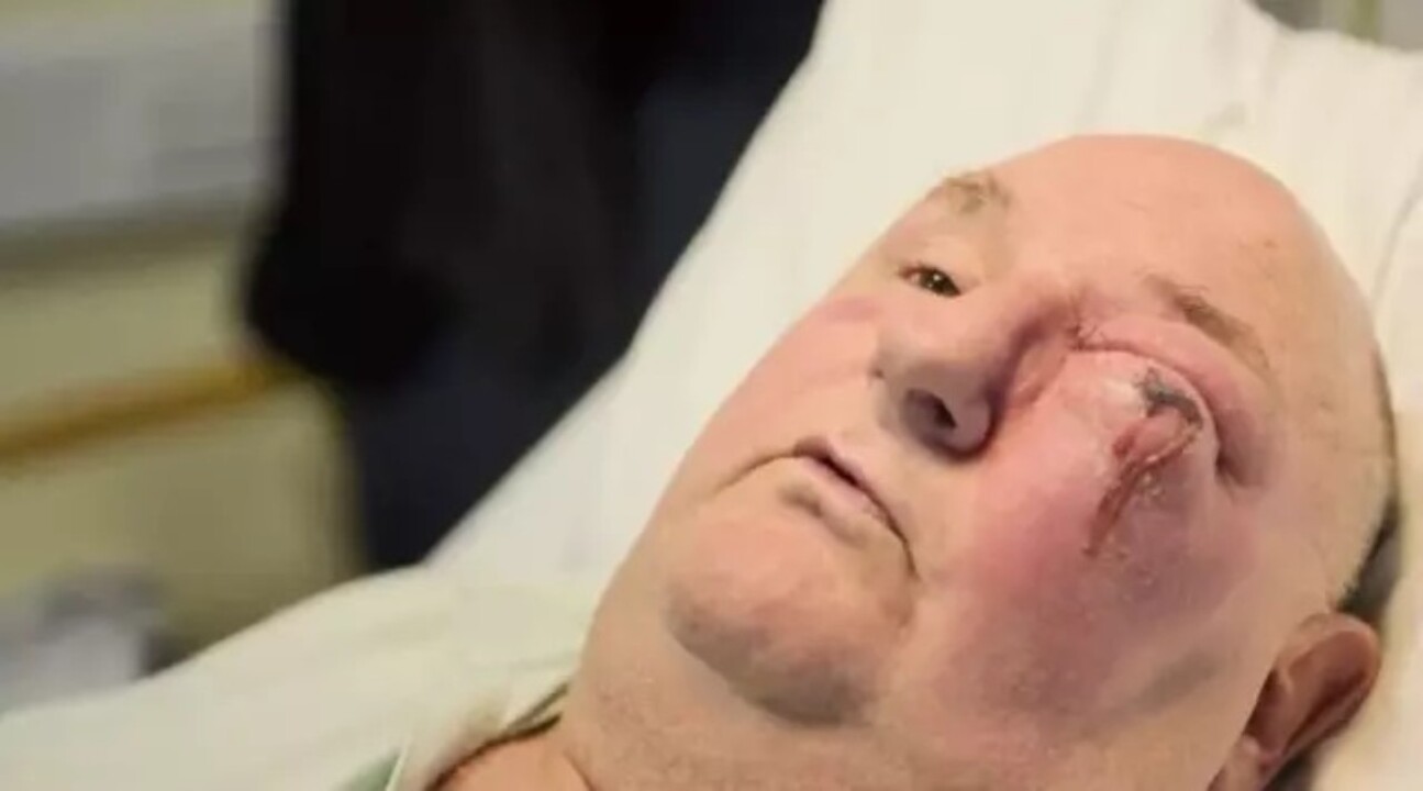 Diş ağrısıyla gitti, et yiyen hastalıkla tanıştı