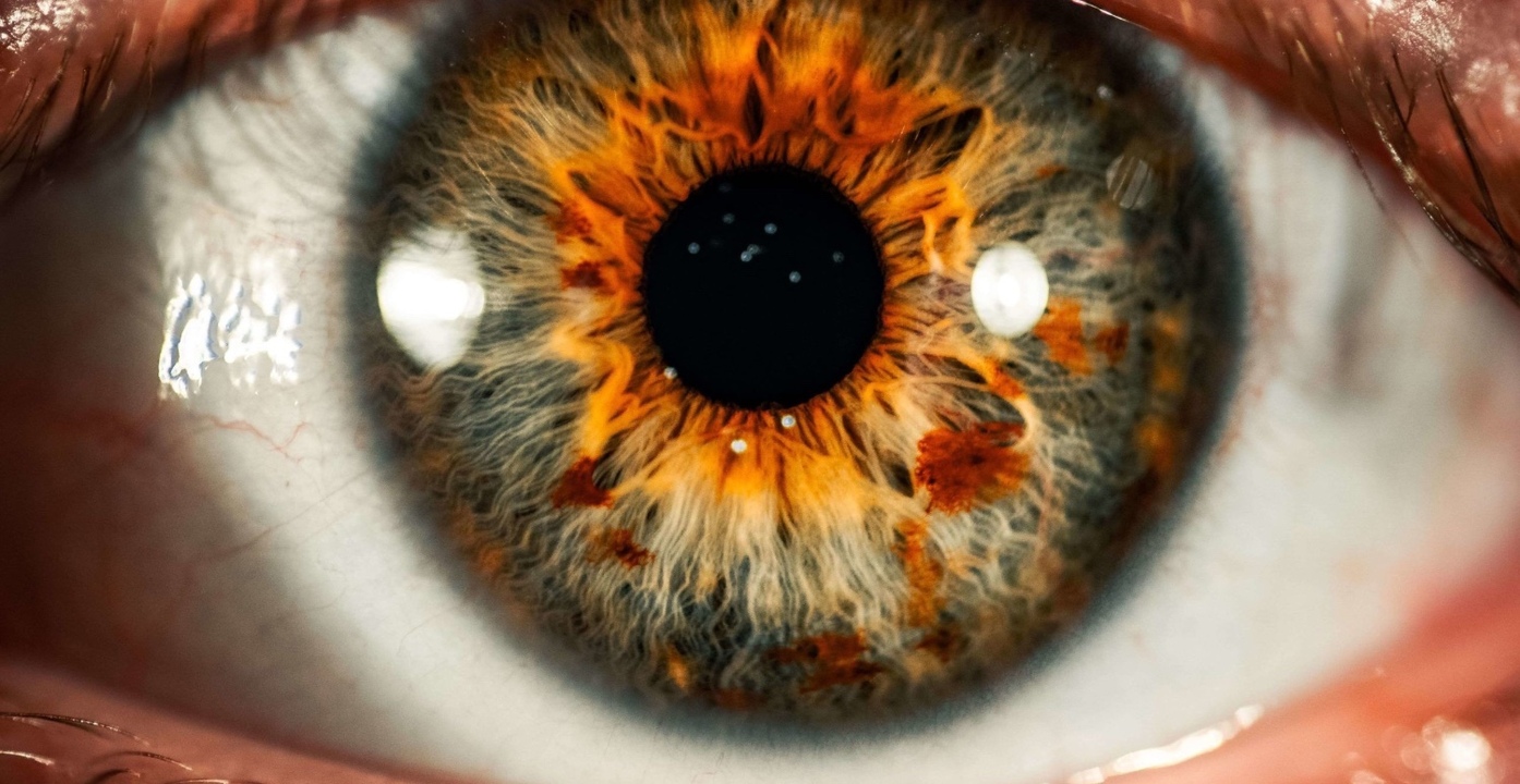 Sürekli gözünü ovuşturanlar dikkat: Kornea nakli gerekebilir!